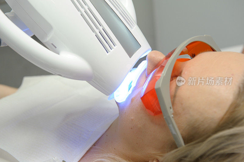 一个女人的面部特写在设备超越Poluse Plus先进美白系统与牙科紫外线激光美白设备的眼镜保护紫外线美白牙齿